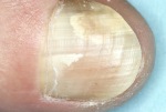 La salud de las uñas nos pueden indicar el nivel de silicio.