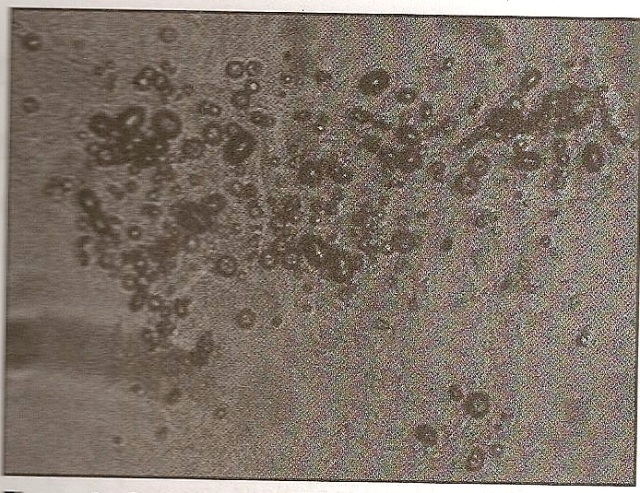 Estructuras celulares en un sustrato gelatinoso en la preparación de biones de tierra. x150. Ref; Heretic's Notebook Pag 90.